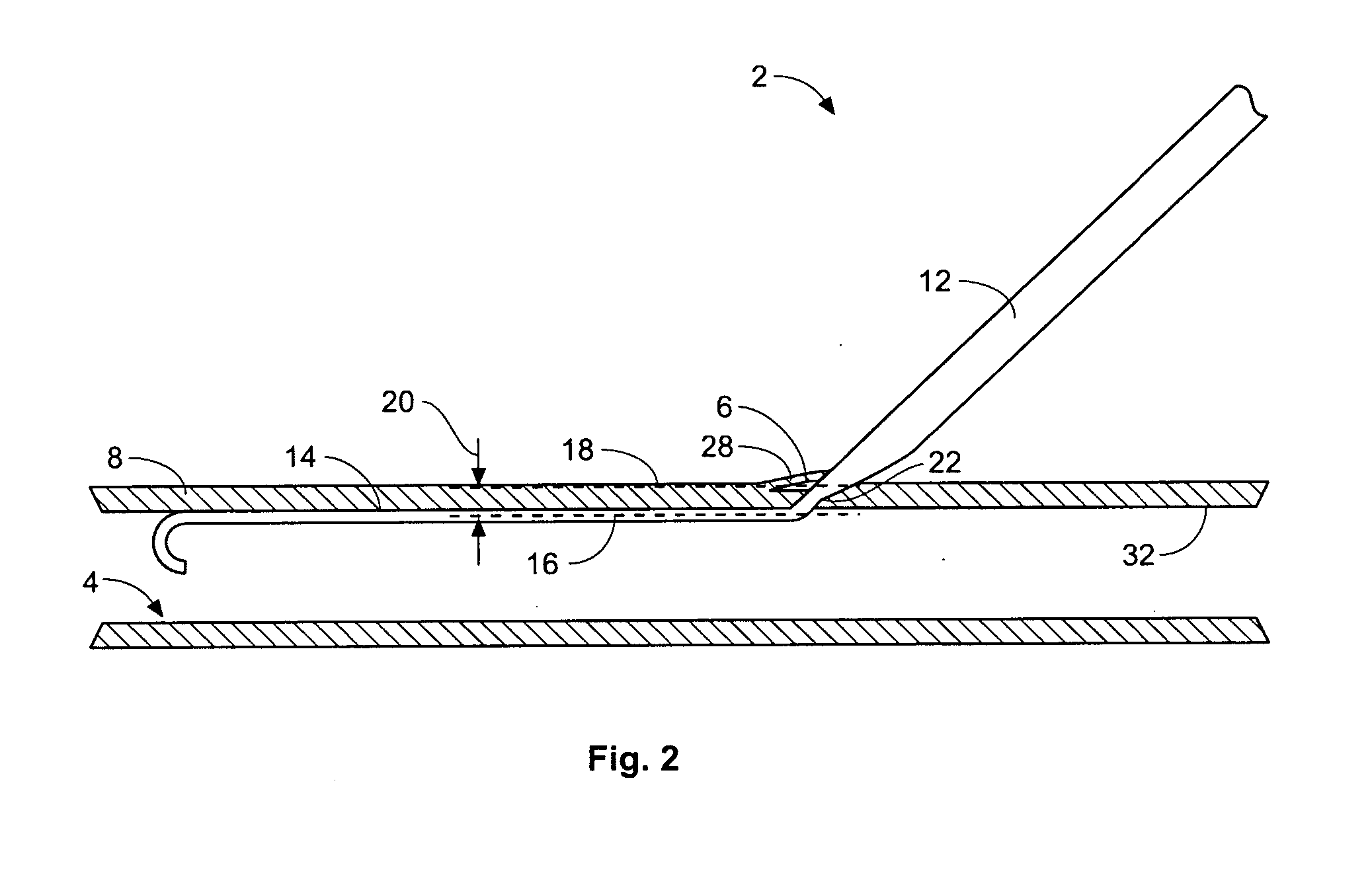 Access and closure device and method