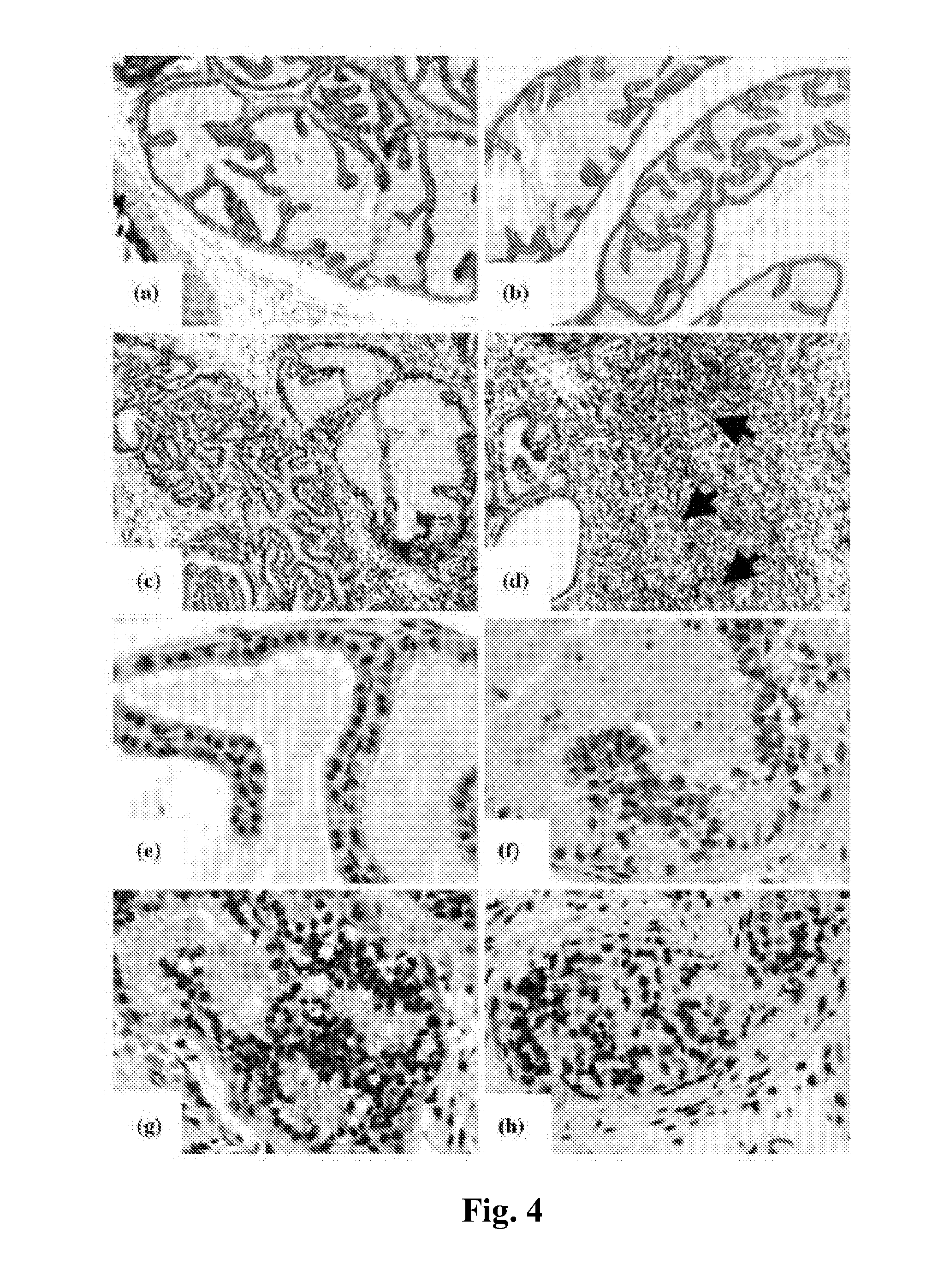 Animal Model of Prostate Cancer and Use Thereof