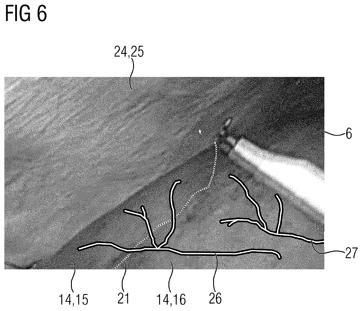 Medical imaging device, method for supporting medical personnel, computer program product, and computer-readable storage medium