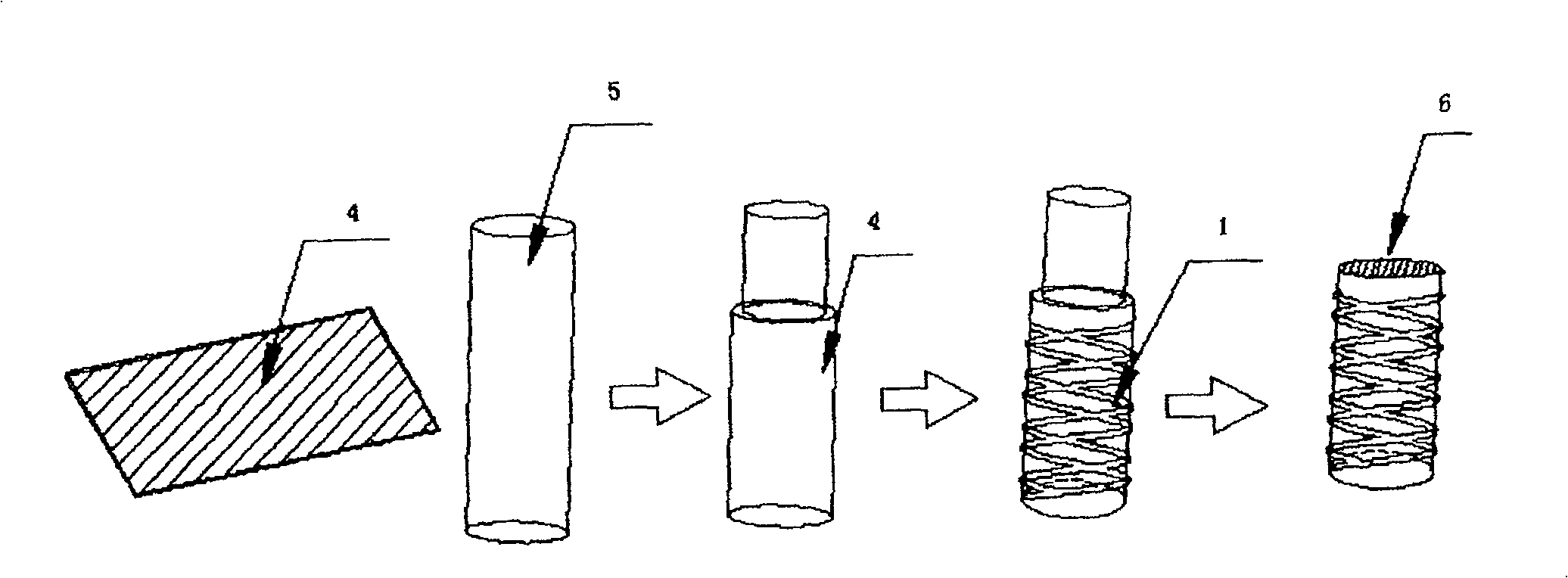 Imaginal stem cell membrane stent in blood vessel, and preparing method thereof