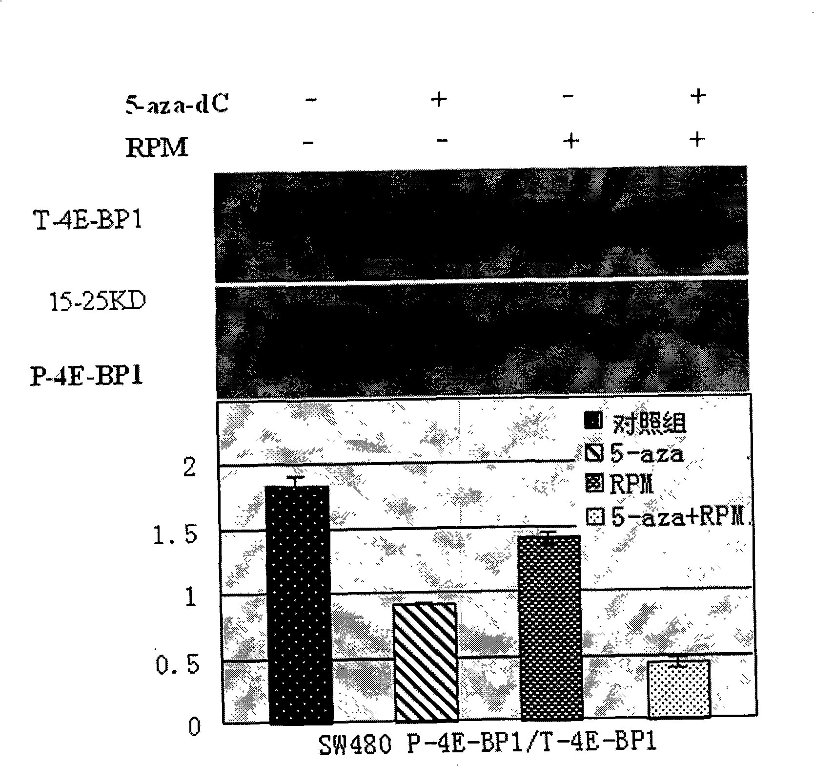 Pharmaceutical composition for treating large intestinal cancer