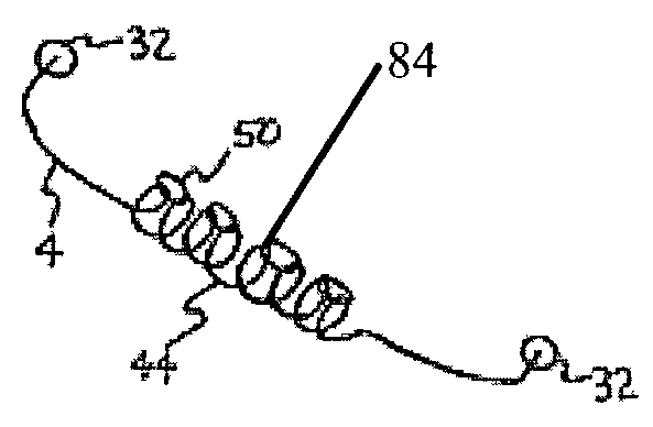 Systems for heart treatment