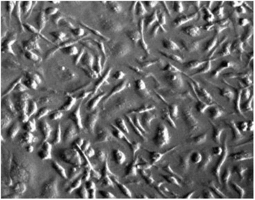 Extraction method of mouse liver sinusoidal endothelial cells