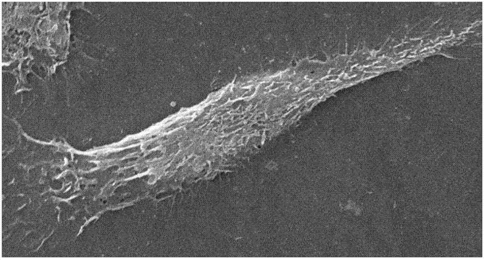 Extraction method of mouse liver sinusoidal endothelial cells