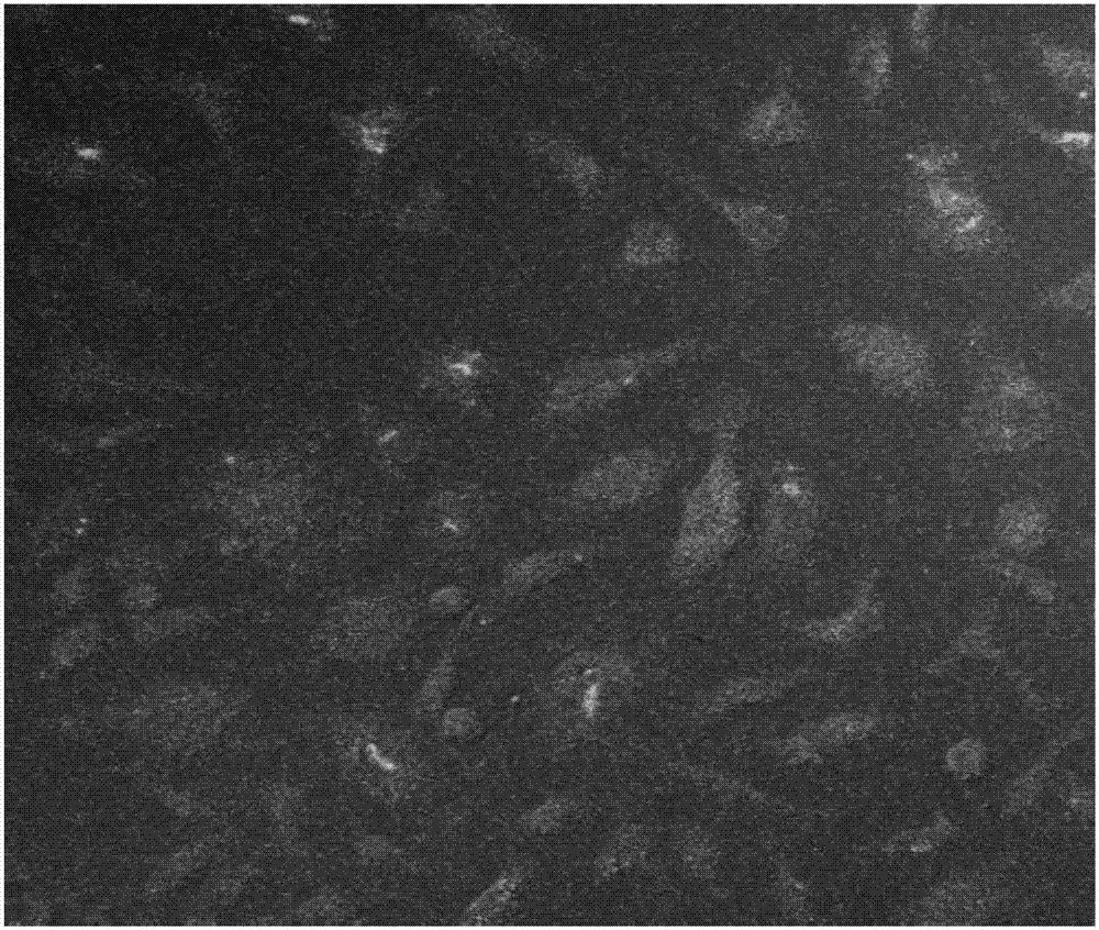 Extraction method of mouse liver sinusoidal endothelial cells