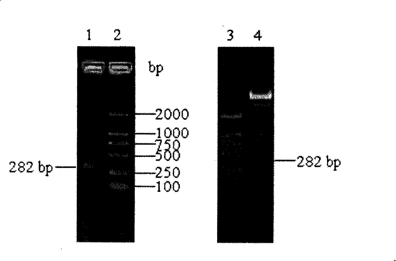 Human oophoroma tumor marker HE4 enzymoimmunoassay kit