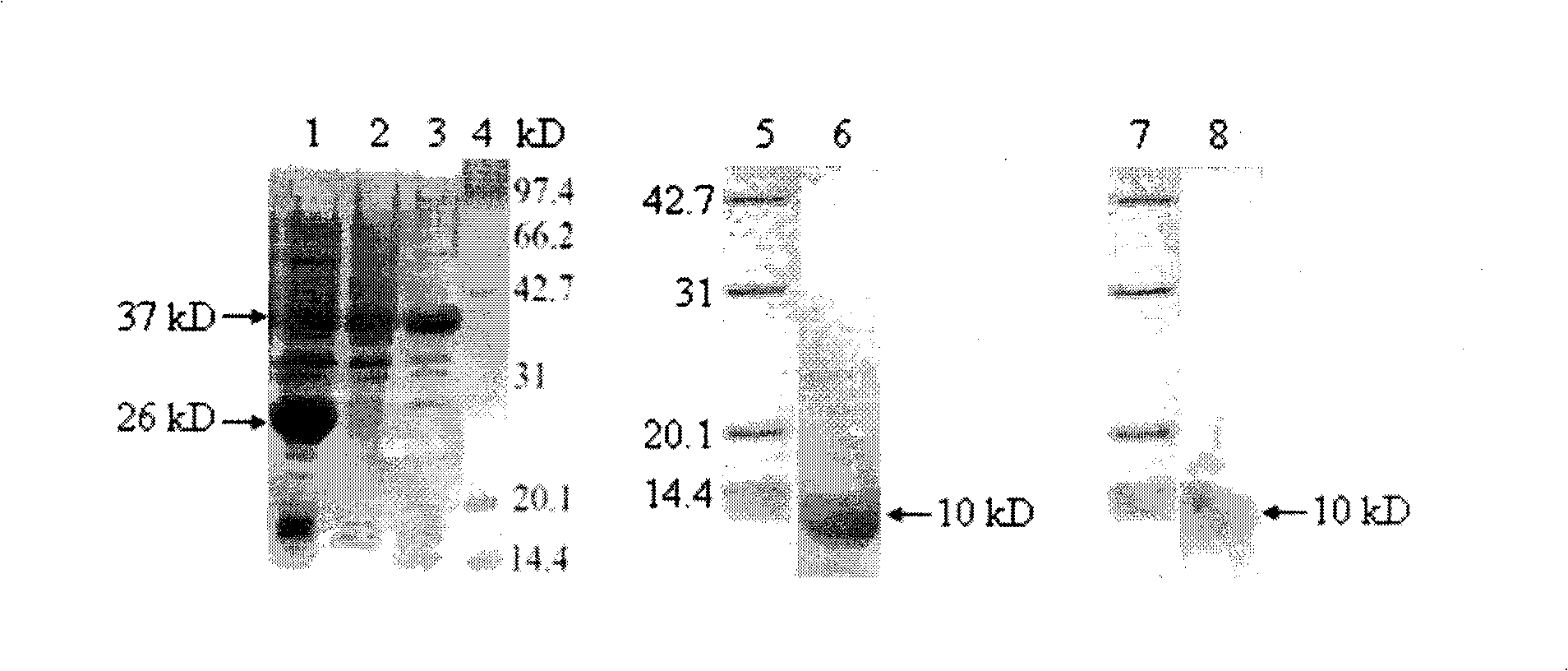 Human oophoroma tumor marker HE4 enzymoimmunoassay kit