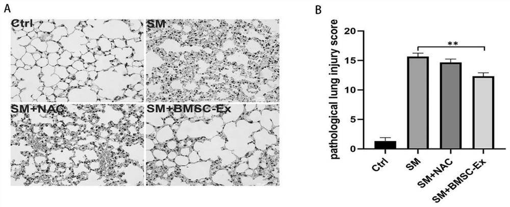 Application of exosome derived from mesenchymal stem cells in preparation of medicine for treating acute lung injury caused by sulfur mustard