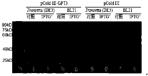 Kit for detecting anti-GP73 antibody in serum