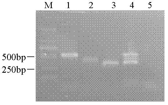 Method for synchronously detecting porcine circovirus type 2 (PCV2), classical swine fever virus (CSFV) and porcine reproductive and respiratory syndrome virus (PRRSV)