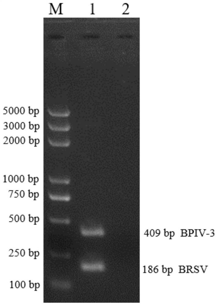 Double rpa detection kit for bovine parainfluenza virus and bovine respiratory syncytial virus