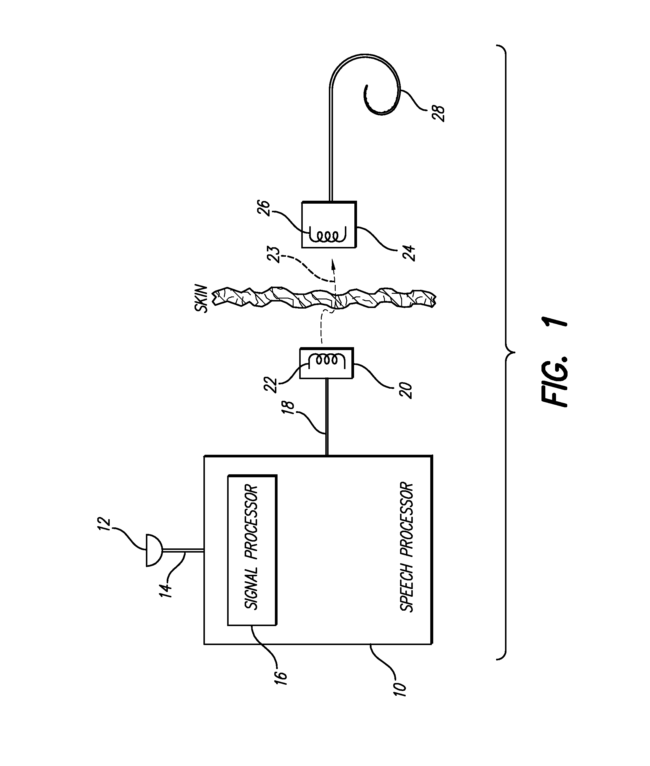 Distributed compression amplitude mapping for a neural stimulation system