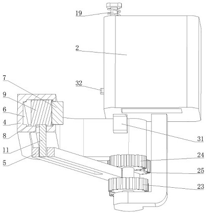 Minimally invasive auxiliary device for pediatric tumor