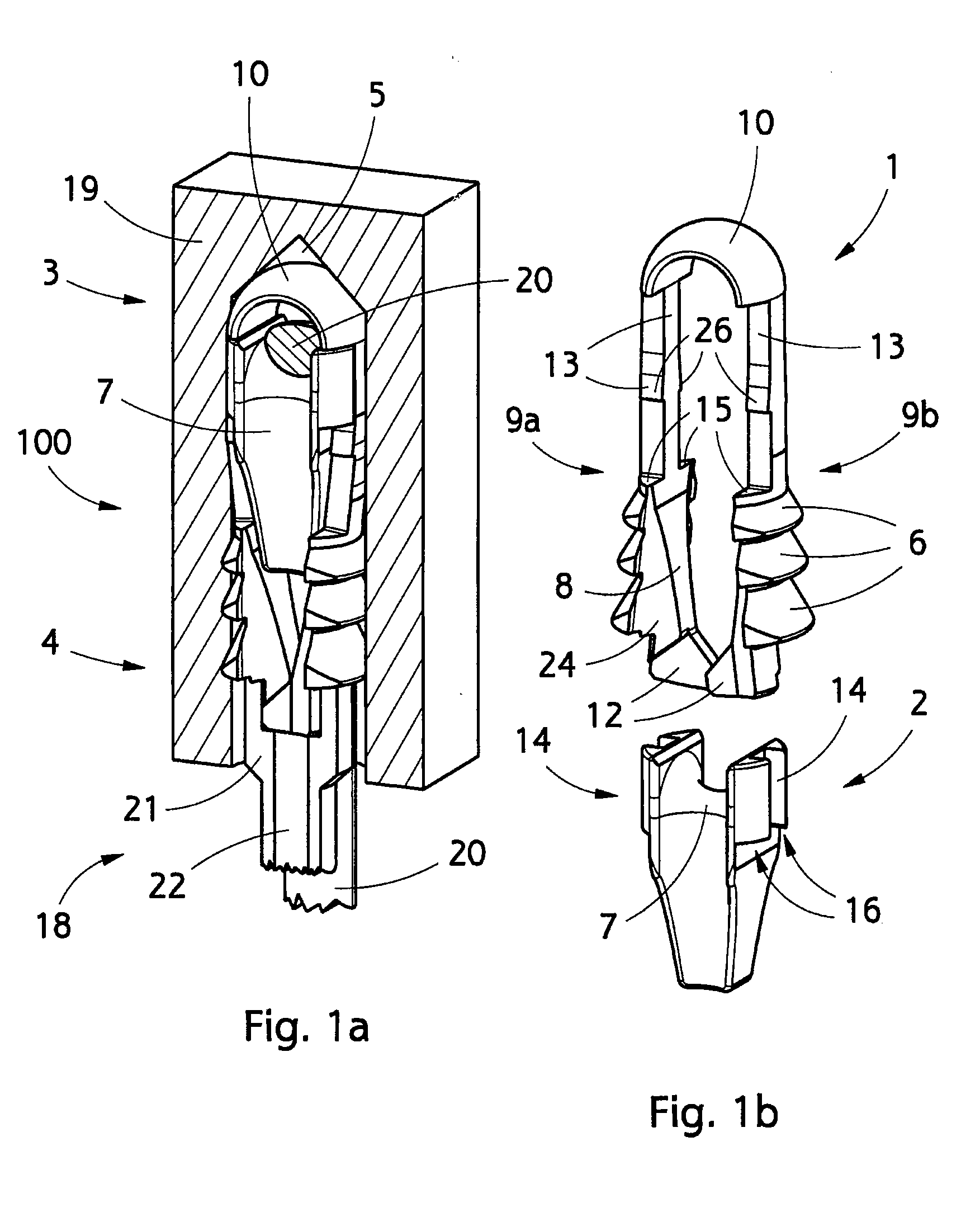 Implant and use thereof