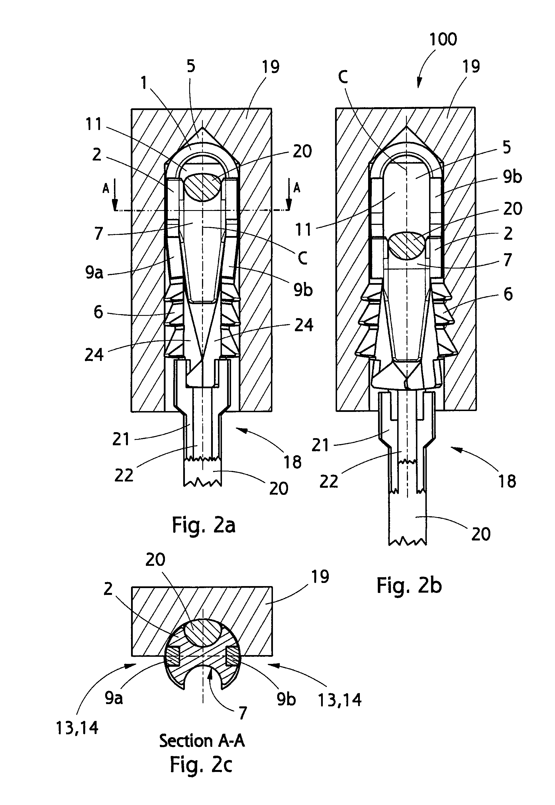 Implant and use thereof