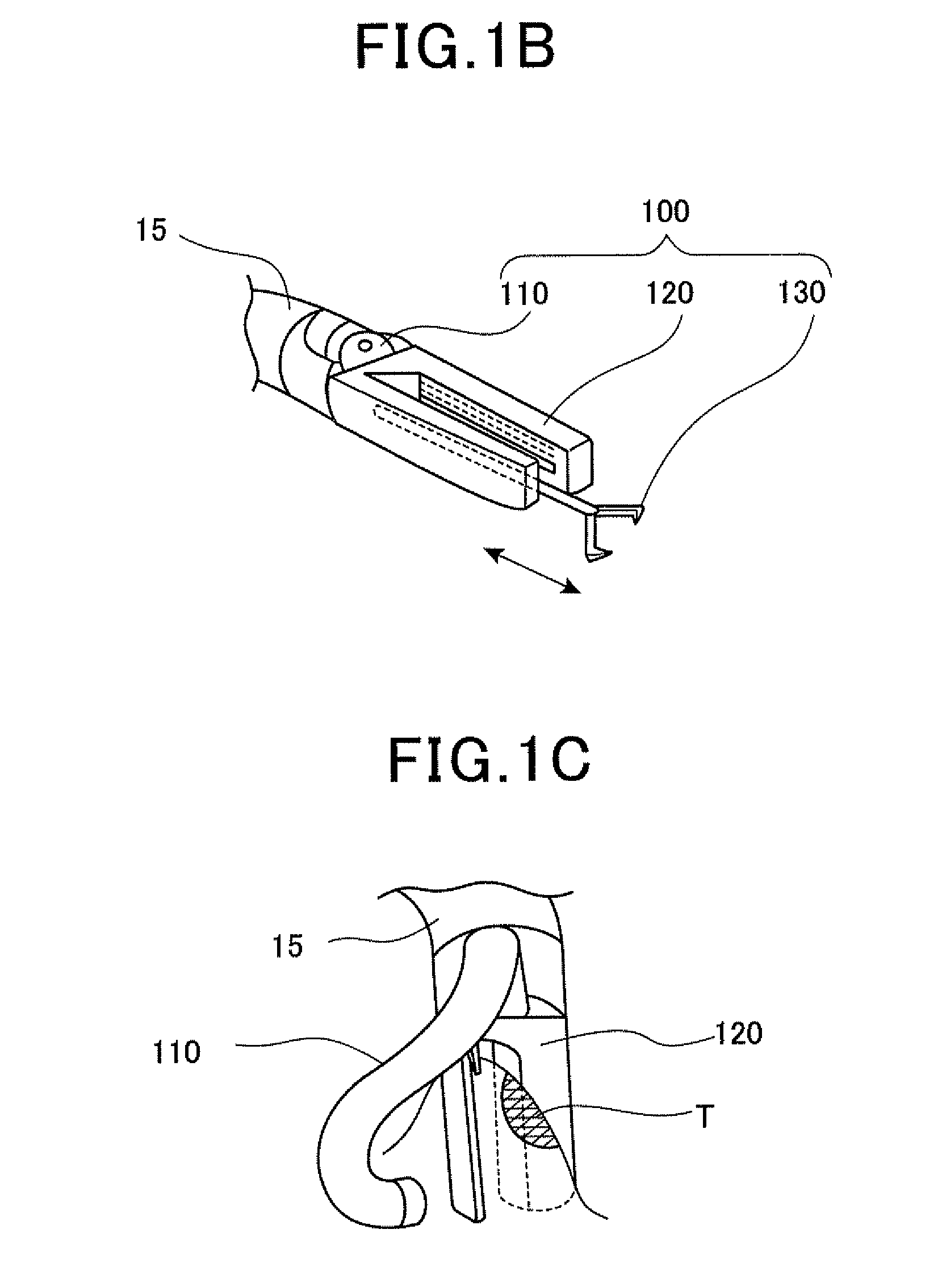 Operative method for lumen