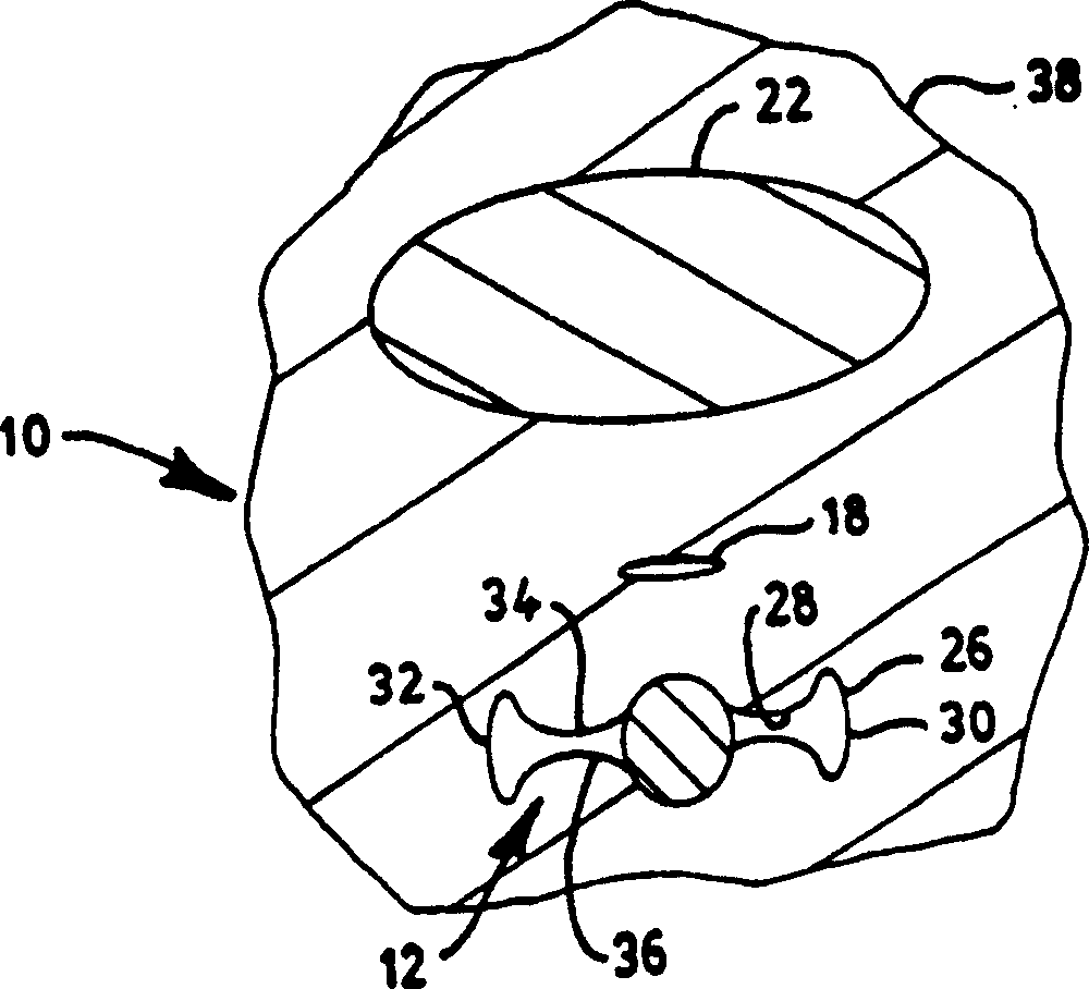 Method for alleviating female urinary incontinence