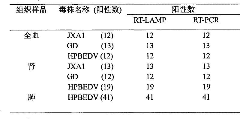 Method for detecting high-pathogenicity blue ear disease