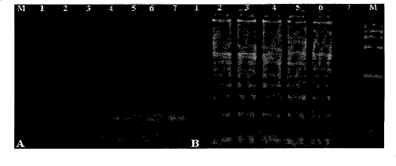 Method for detecting high-pathogenicity blue ear disease