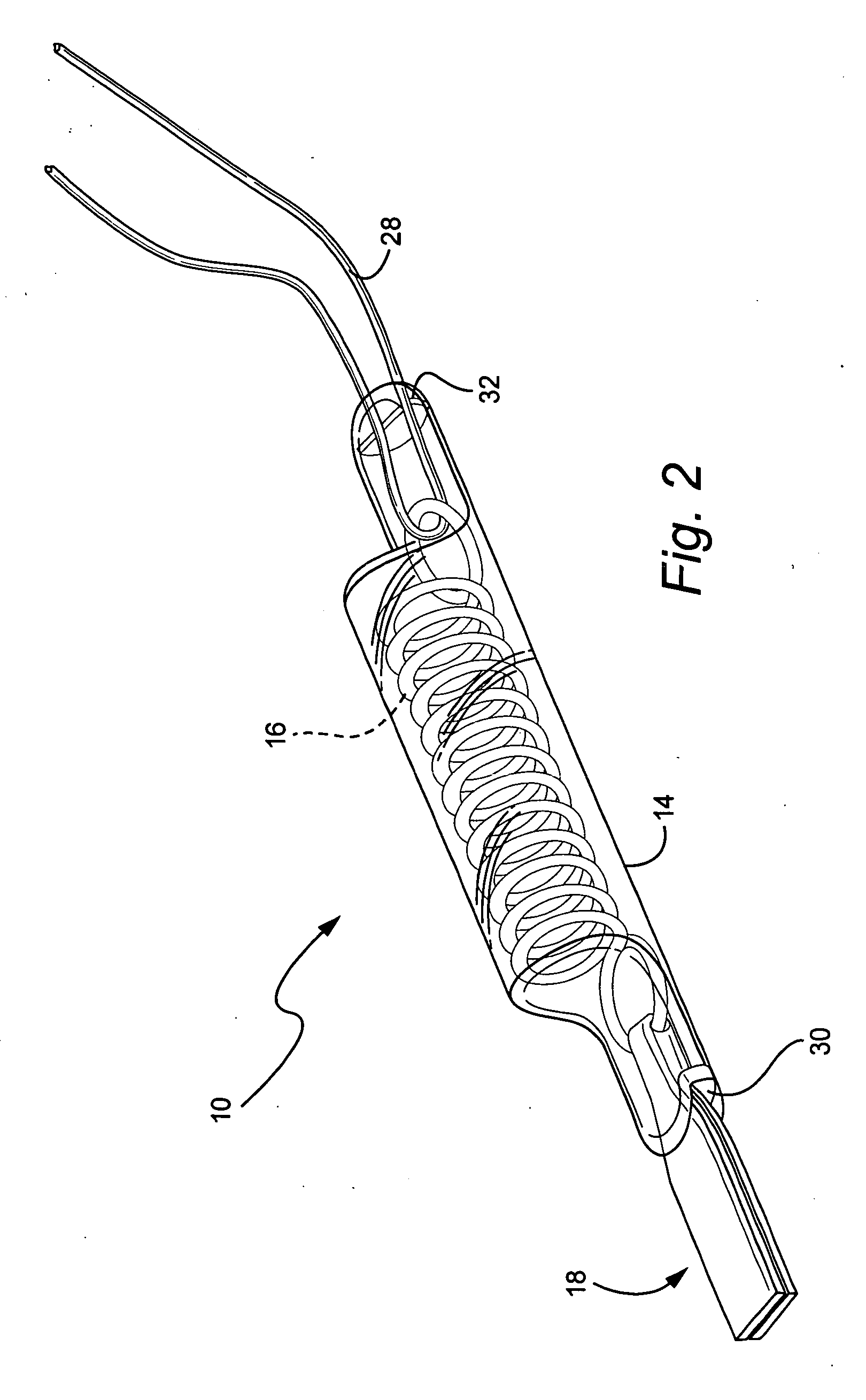 Extraocular muscle prosthesis