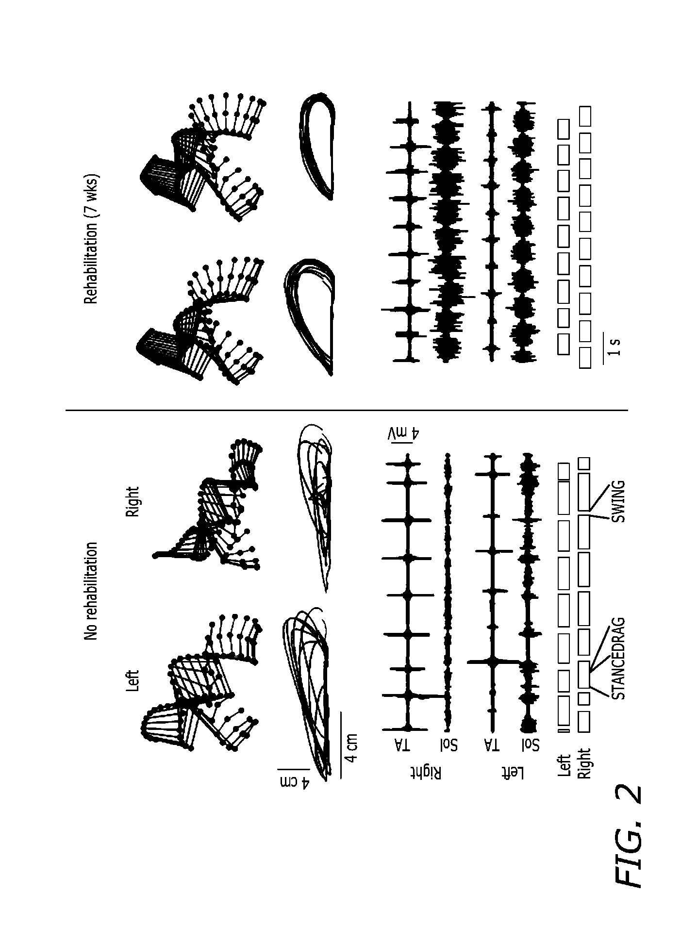 High density epidural stimulation for facilitation of locomotion, posture, voluntary movement, and recovery of autonomic, sexual, vasomotor, and cognitive function after neurological injury