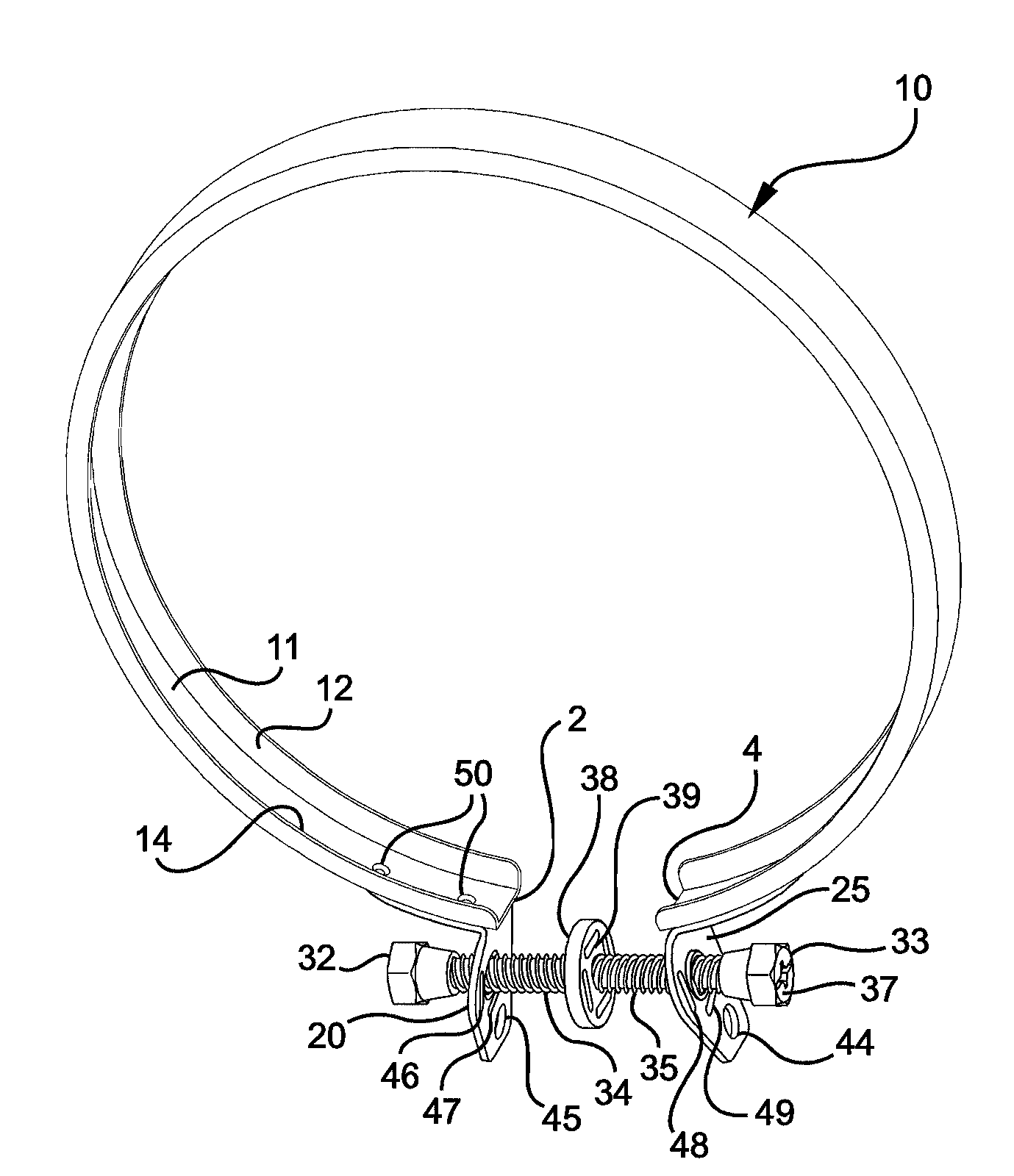 Sealing ring with improved fastener