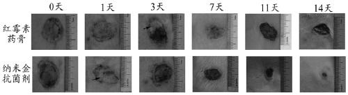 A kind of preparation method containing nano-gold antibacterial agent