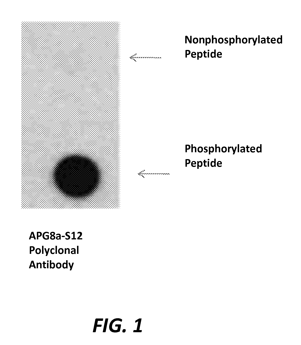 Regulation of apg8 phosphorylation and uses thereof