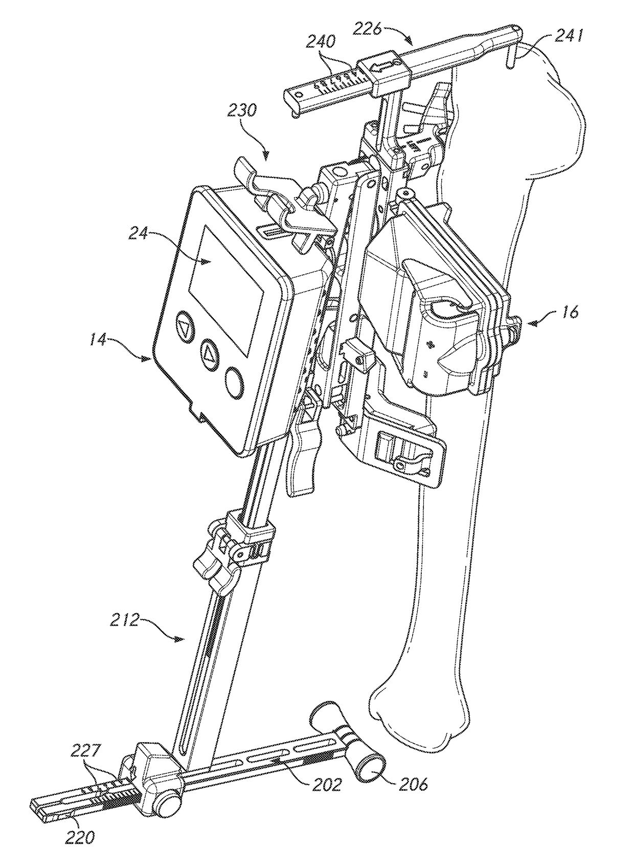 Soft tissue measurement & balancing systems and methods