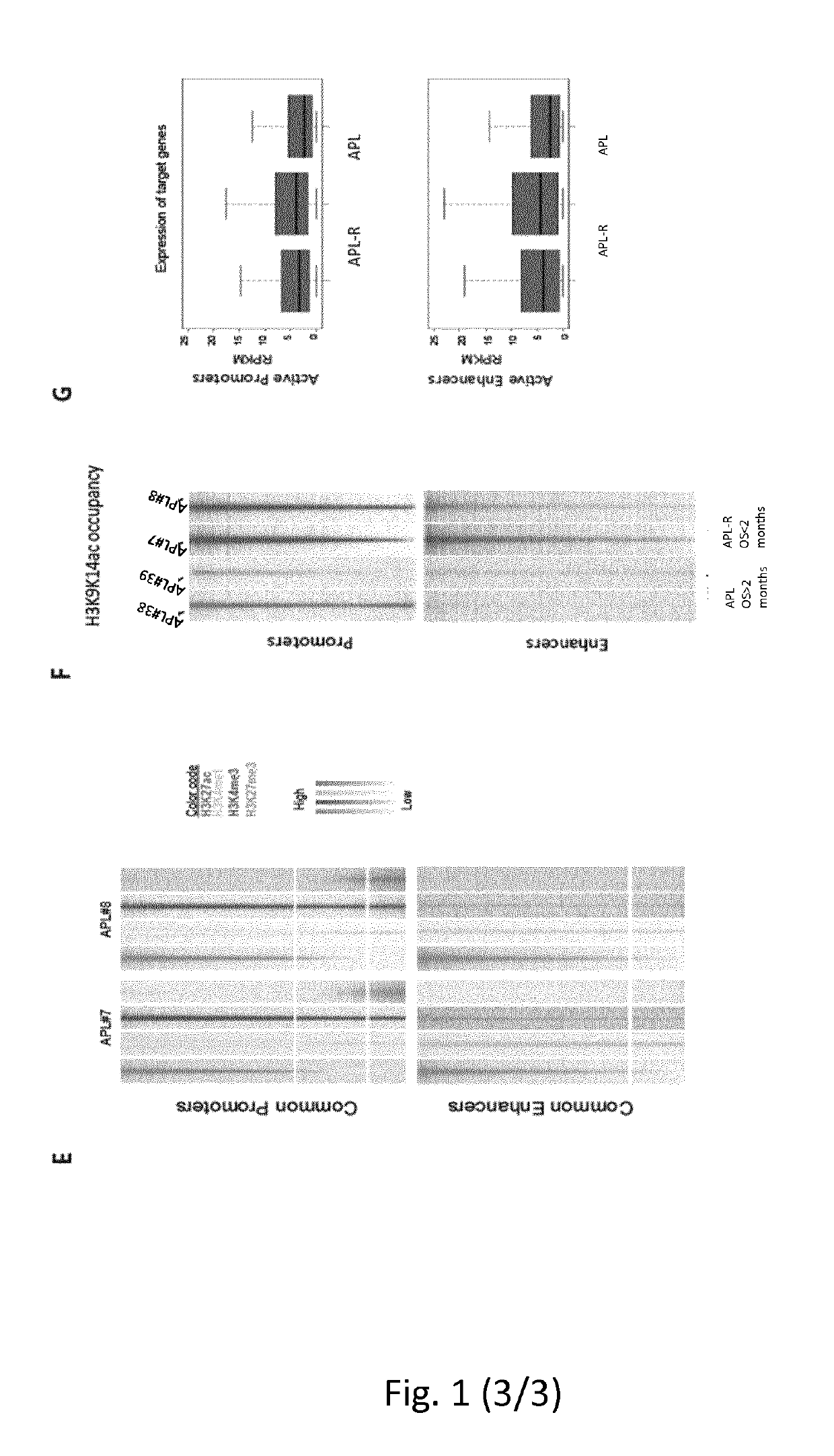 Method for the prognosis and/or treatment of acute promyelocytic leukemia