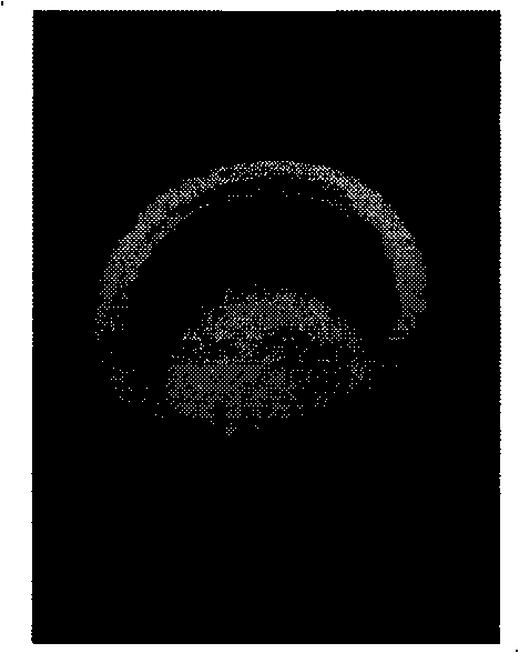 Preparation method of combined porous biological ceramics bracket