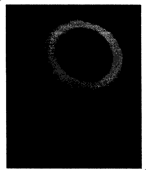 Preparation method of combined porous biological ceramics bracket