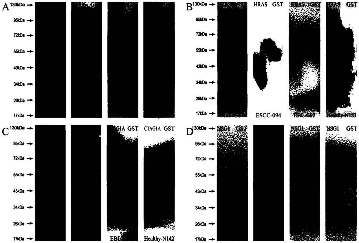 Four-autoantibody combined detection kit for diagnosing early esophageal squamous cancer and application thereof