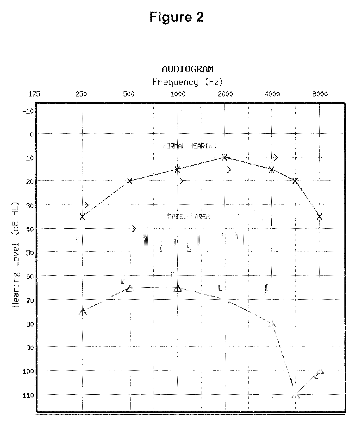 Audiogram classification system