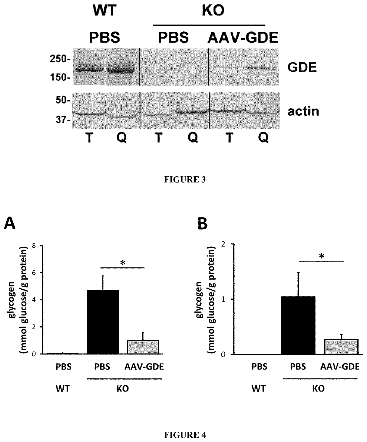 Treatment of glycogen storage disease iii