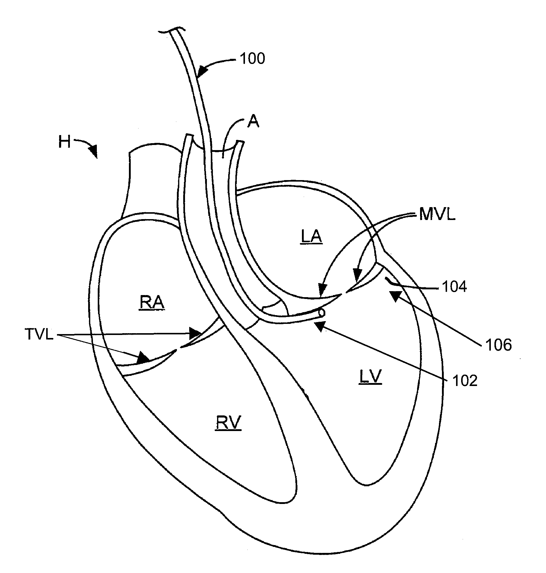 Multi-window guide tunnel