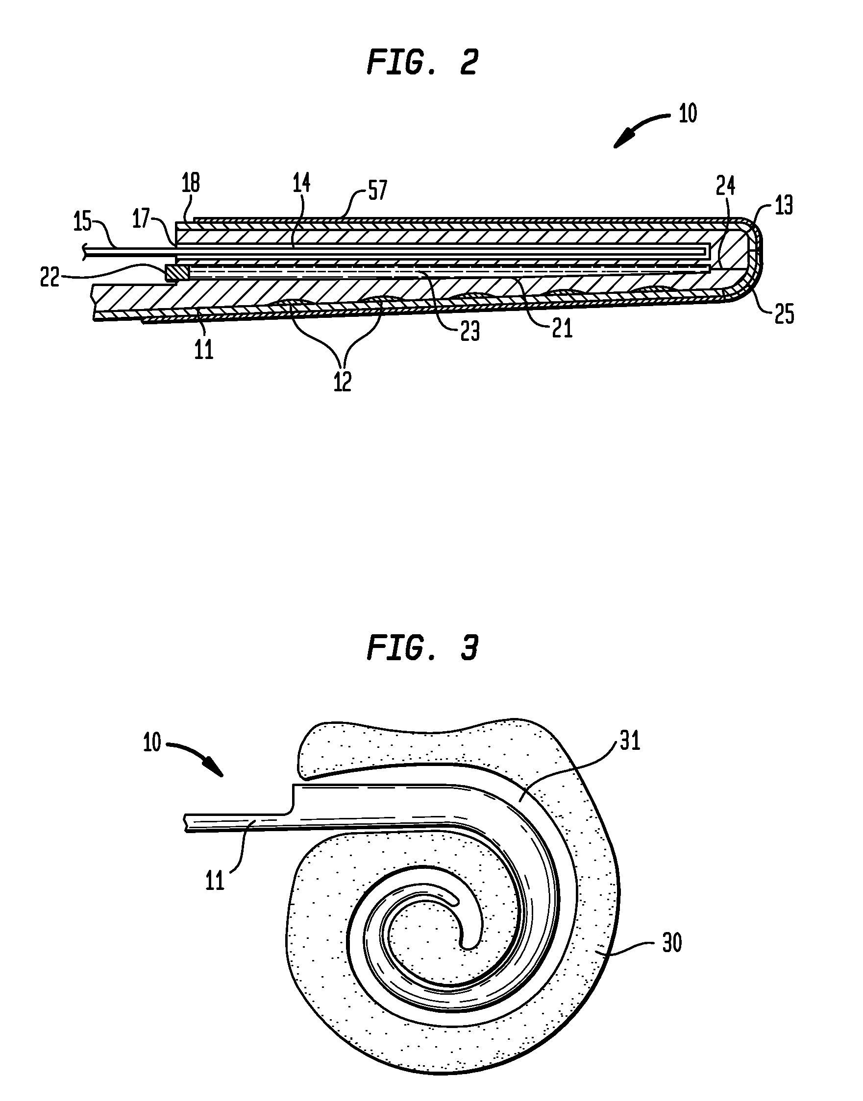 Apparatus for delivery of pharmaceuticals to the cochlea