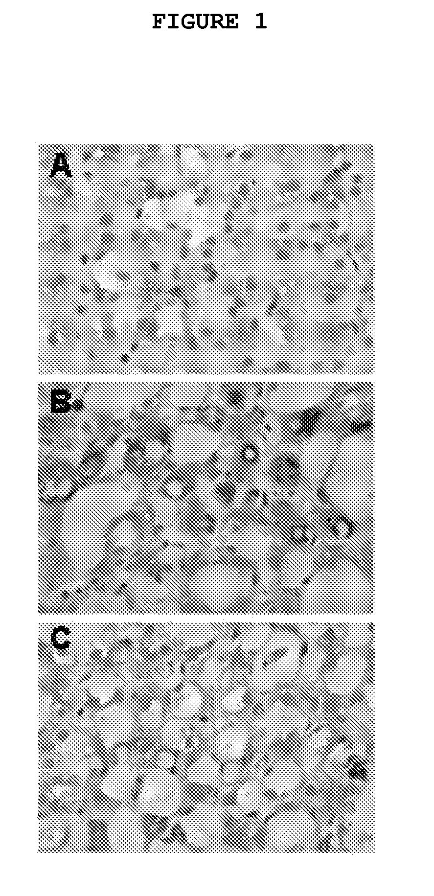 Composition and Method for Treating Fibrotic Diseases