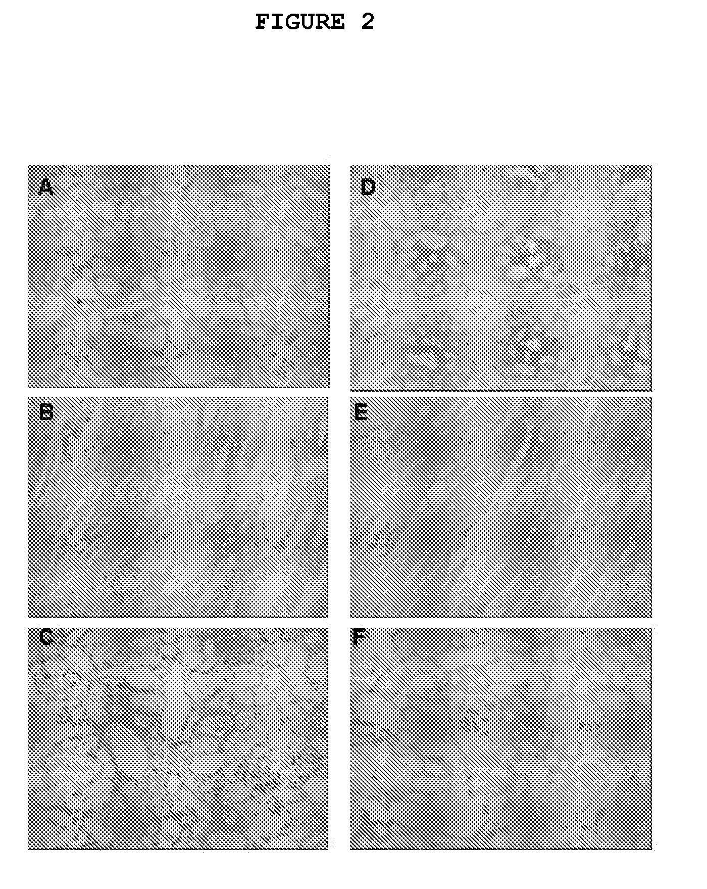 Composition and Method for Treating Fibrotic Diseases