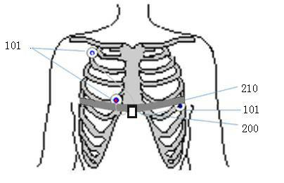 Dynamic electrocardiogram and motion recording and analyzing system