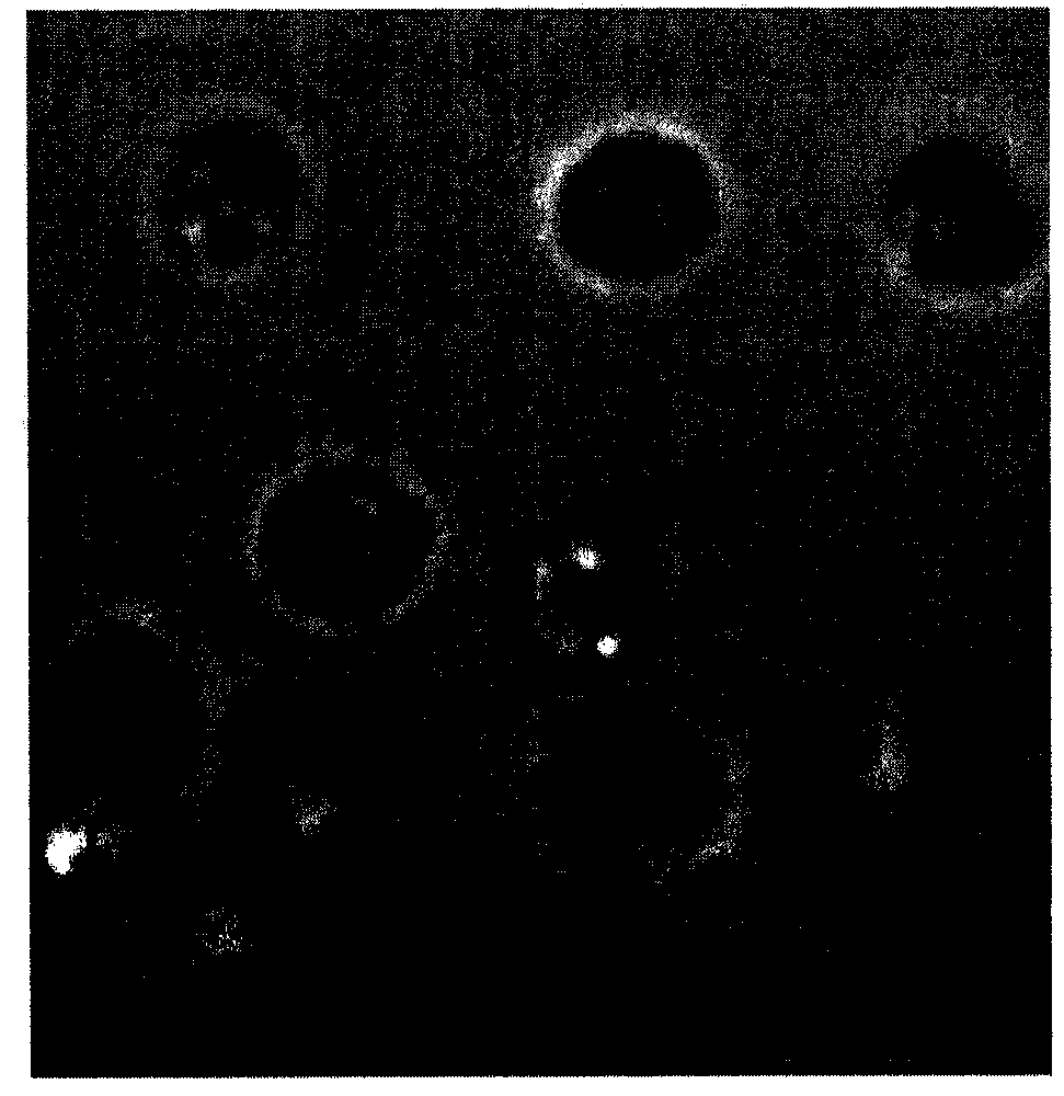 Method for promoting the massive accumulation of high unsaturated fatty acids in Nannochloropsis