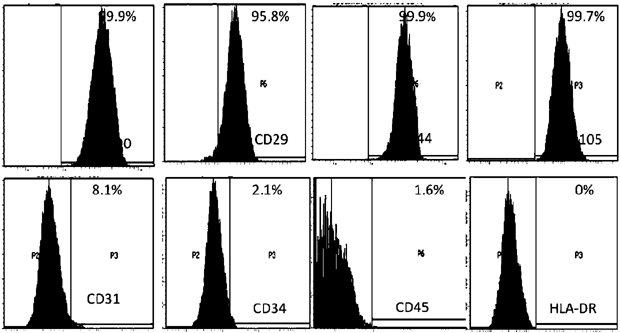 Cell preparation for treating inflammatory enteritis