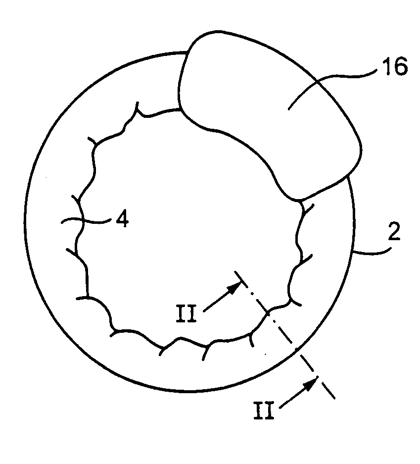 Multi-material incontinence treatment construction device