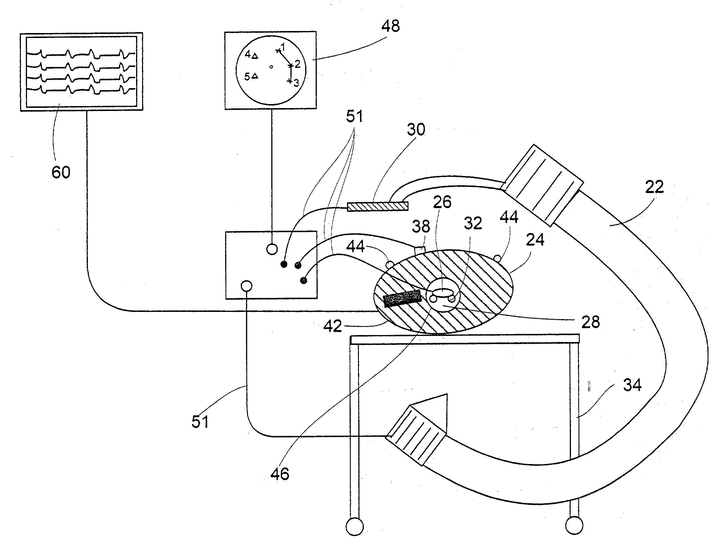 System and method of recording and displaying in context of an image a location of at least one point-of-interest in a body during an intra-body medical procedure