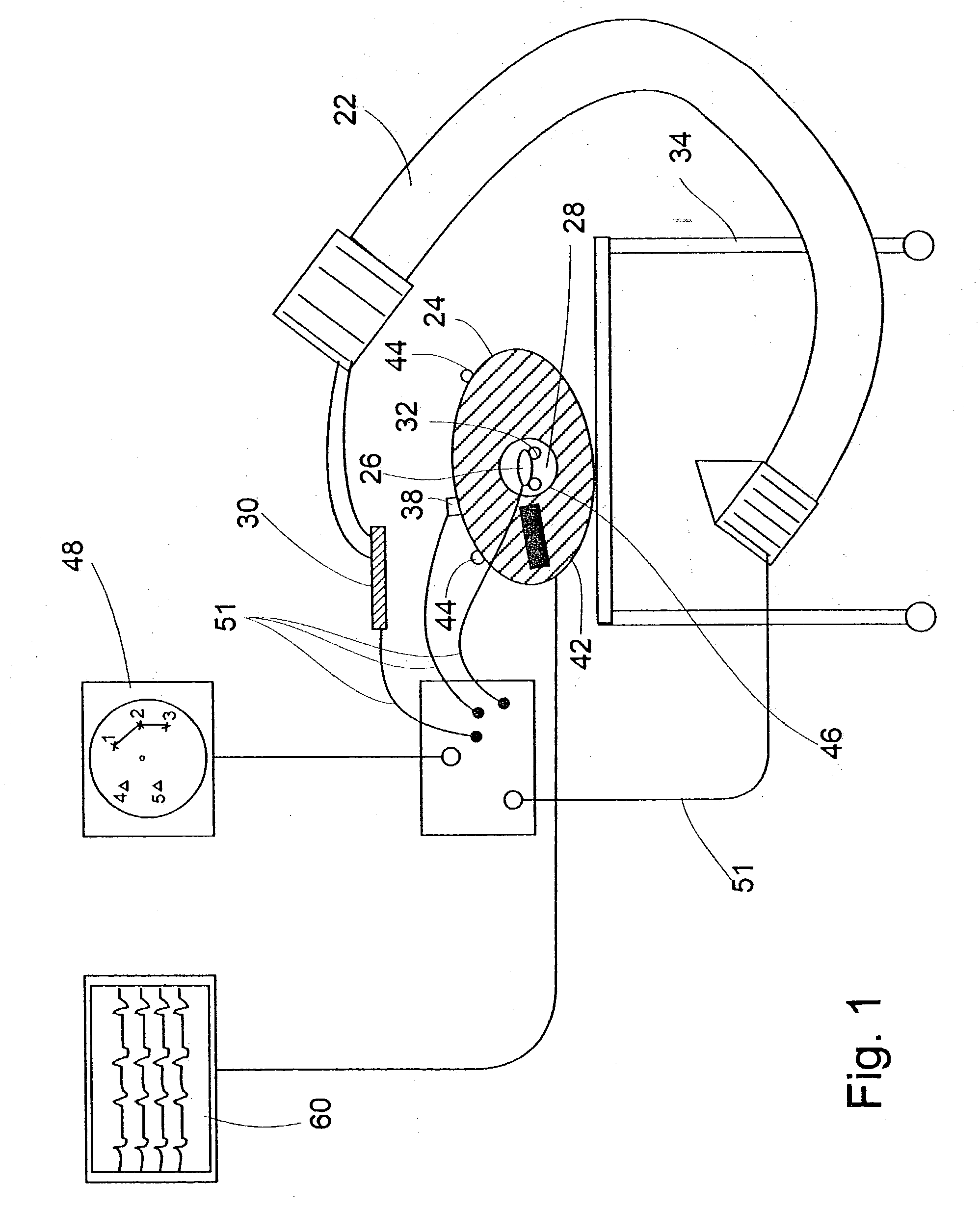 System and method of recording and displaying in context of an image a location of at least one point-of-interest in a body during an intra-body medical procedure