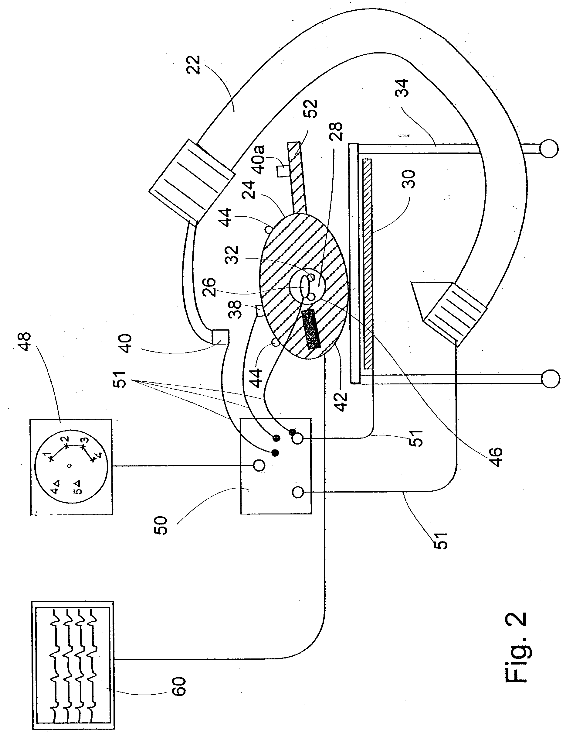 System and method of recording and displaying in context of an image a location of at least one point-of-interest in a body during an intra-body medical procedure