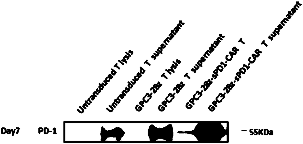 Chimeric antigen receptor-modified immune effector cell co-expressing PD-L1 blocker