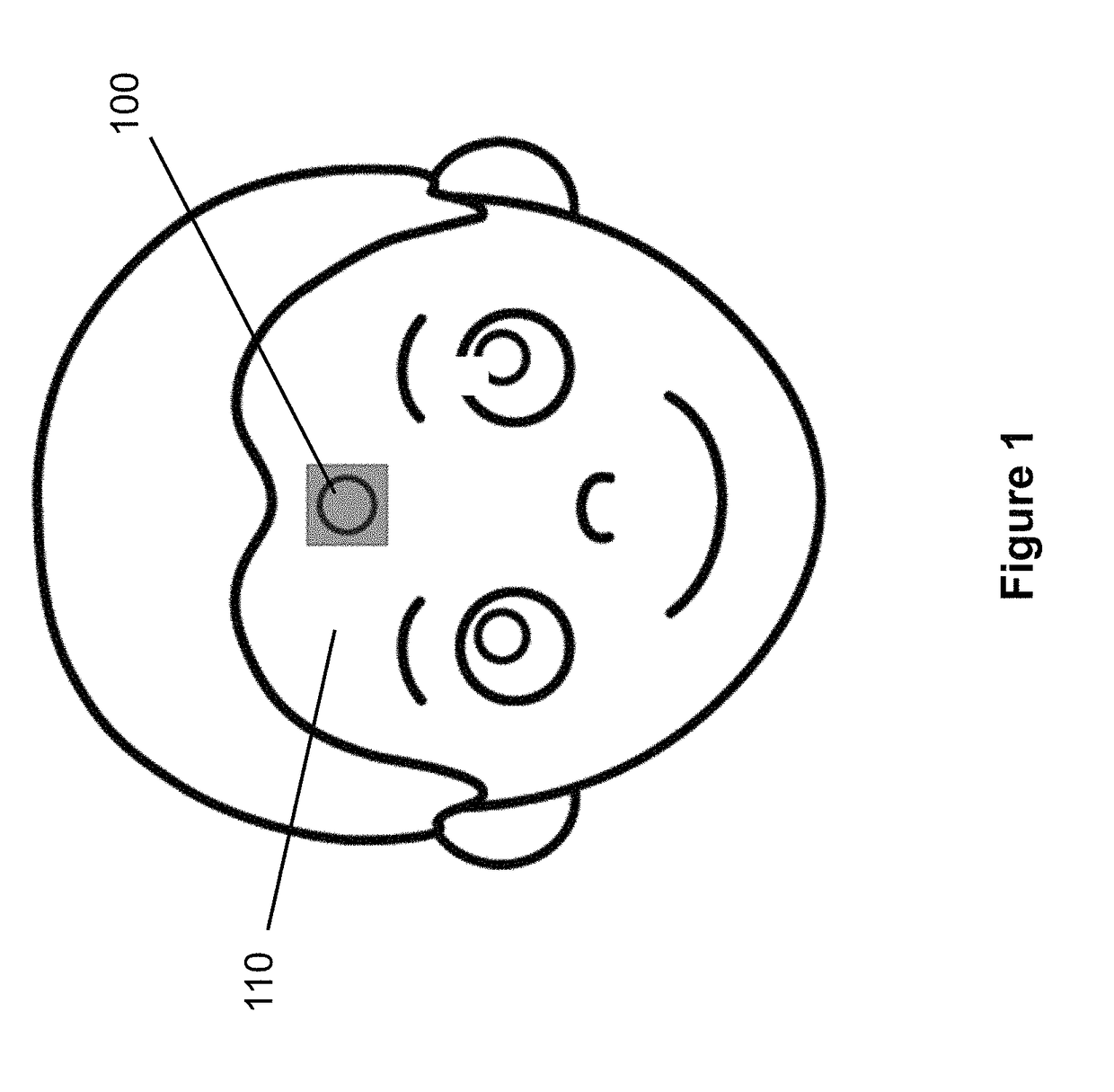 Compliant wearable patch capable of measuring electrical signals