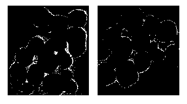 Preparation method of folic acid self-assembled water-soluble rare-earth doped up-converted nanometer material