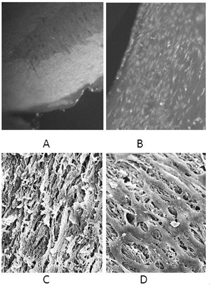 Artificial nerve graft and preparation method based on sliced ​​decellularized scaffold